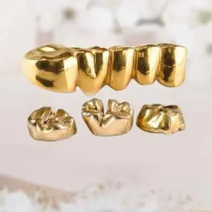 Zahngoldankauf & Zahngoldverkauf in der Nähe – Serhano’s Juwelier