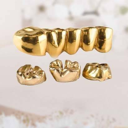 Zahngold Ankauf in der Nähe