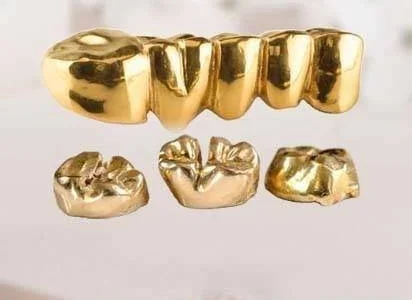 Zahngold Ankauf in der Nähe
