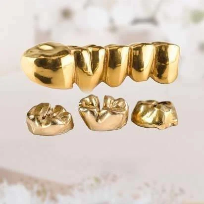 Zahngold Ankauf in der Nähe